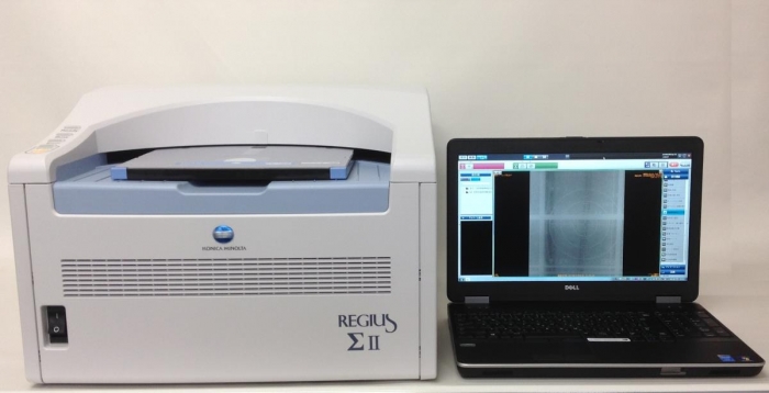 REGIUS ΣⅡ(X線デジタル撮影装置)